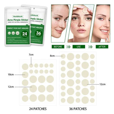 Waterproof Acne Remover Patch